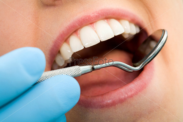 Close-up of female with open mouth during oral checkup at the dentist?s