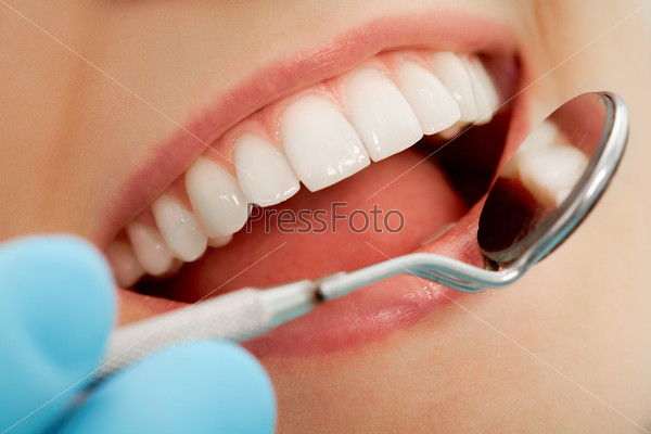 Close-up of patient?s open mouth during oral checkup with mirror near by