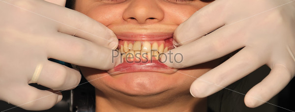 Проверка зубов у дантиста