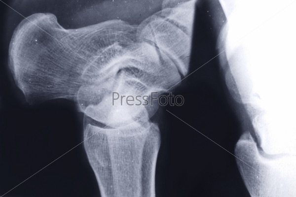 X-ray of human skeleton