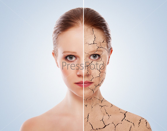 concept of cosmetic effects, treatment and skin care.  face of young woman before and after the procedure