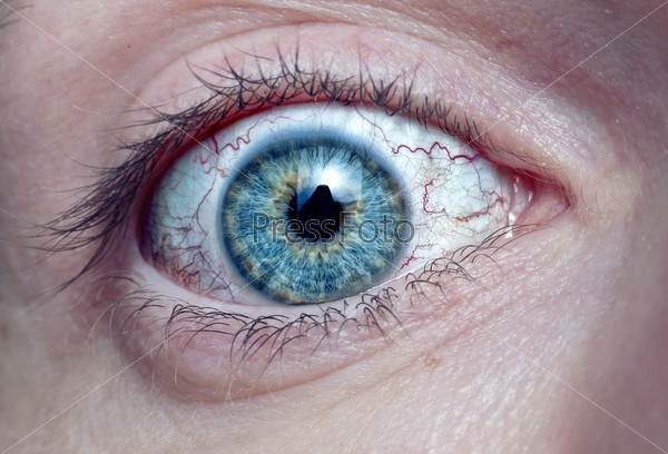 men eye with red blood vessels macro