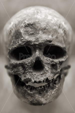Human skull bone