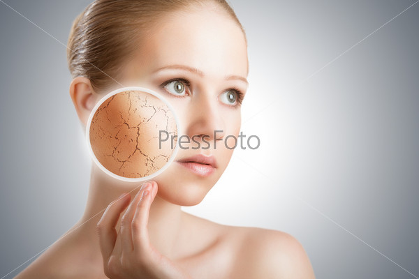 Concept of cosmetic skin care. face of young woman with dry ski