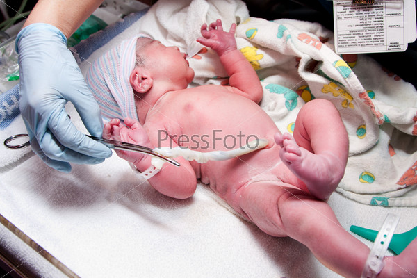 Newborn cute infant baby with hand holding clip on umbilical cord at a hospital nursery.