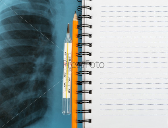 X-ray examination and copy book