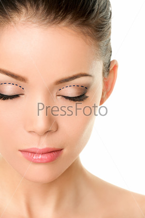 Asian monolids plastic surgery concept - woman with correction marks to have double eyelids made.