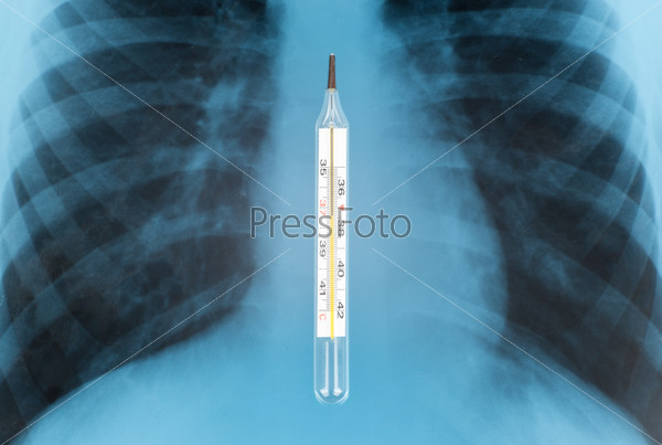 X-ray examination and thermometer