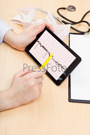 doctor checks patient electrocardiogram on tablet pc