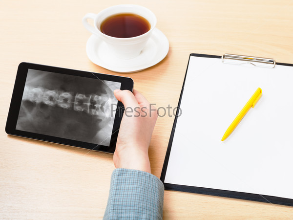 Medic analyzes X-ray picture of vertebral column on screen on tablet pc, stock photo