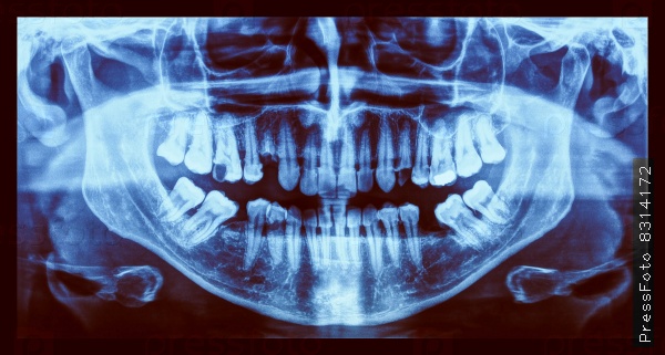 Vintage looking Medical X ray imaging of human teeth