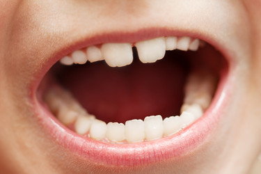 Similar image 177123