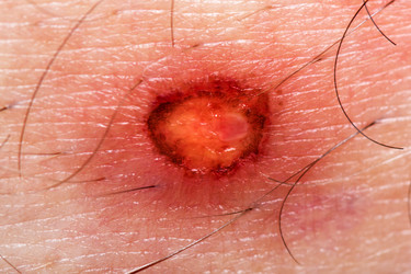 Similar image 240635