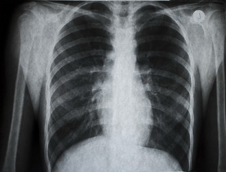 Similar image 354924