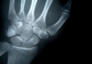 Similar image 515673