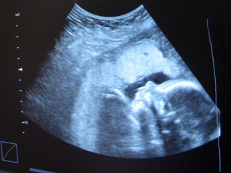 Similar image 748026