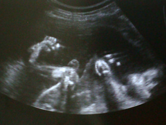 Similar image 761656