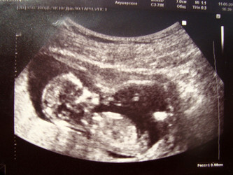 Similar image 761658