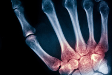 Similar image 791315