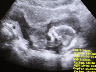 Similar image 793673