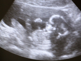 Similar image 825891