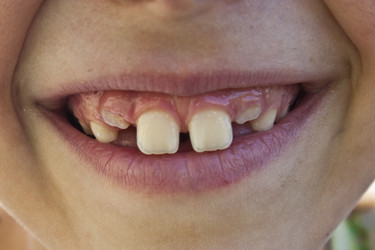 Similar image 857175