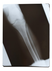 Similar image 965054