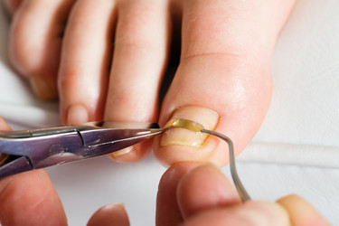 Similar image 1036576