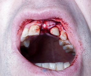 Similar image 1236114