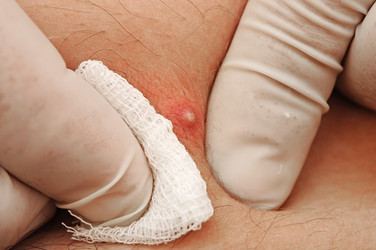 Similar image 1411010