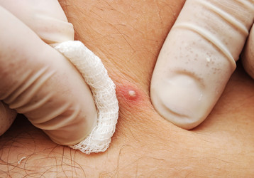 Similar image 1411011