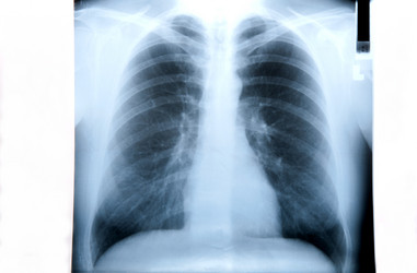 Similar image 1441971