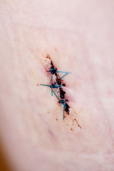 Similar image 1522197