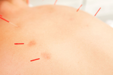 Similar image 1526469