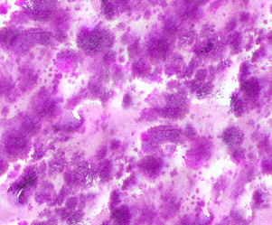 Similar image 1832627