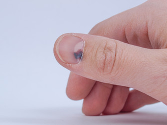 Similar image 1886588