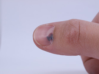 Similar image 2025537