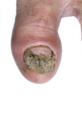 Similar image 2841940