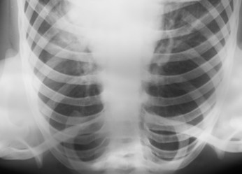 Similar image 2929269