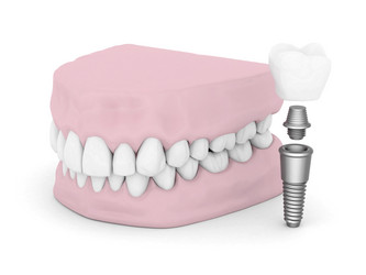 Similar image 2990576