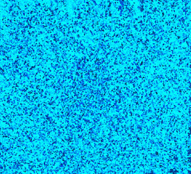 Similar image 5518963