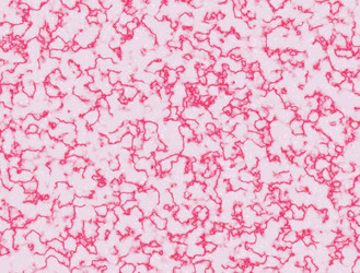 Similar image 5540478