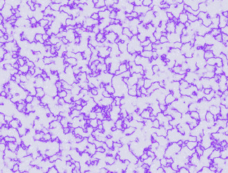 Similar image 5562281