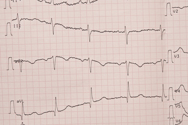 Similar image 5580934