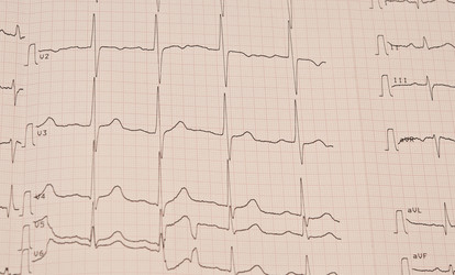 Similar image 5580935