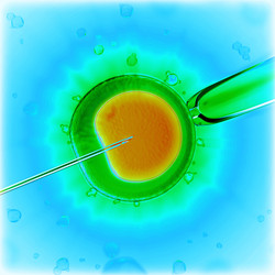 Similar image 5938556