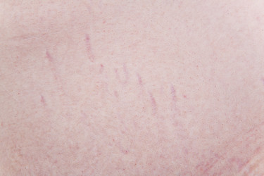 Similar image 6053704