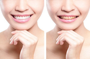 Similar image 6652219