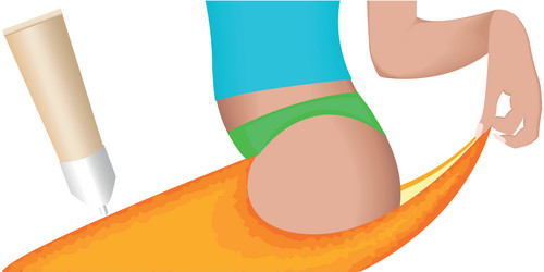 Similar image 7425193