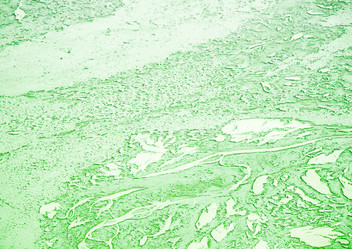 Similar image 7516202